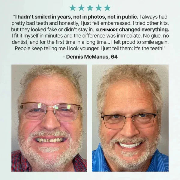 KLENIMORE™ Medical Full Denture with Strong Suction